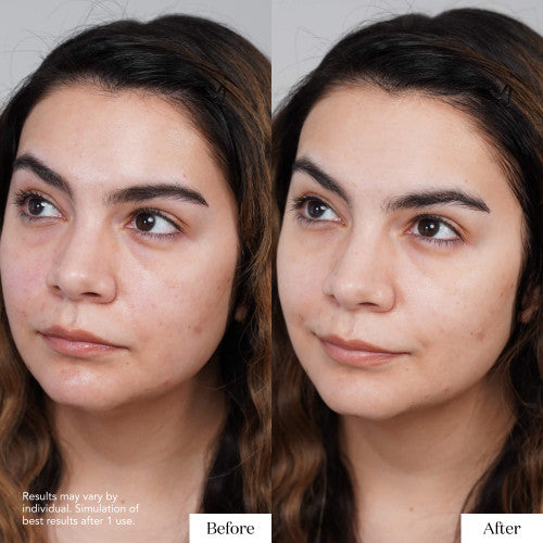 SK-II | PITERA™ Facial Treatment Mask