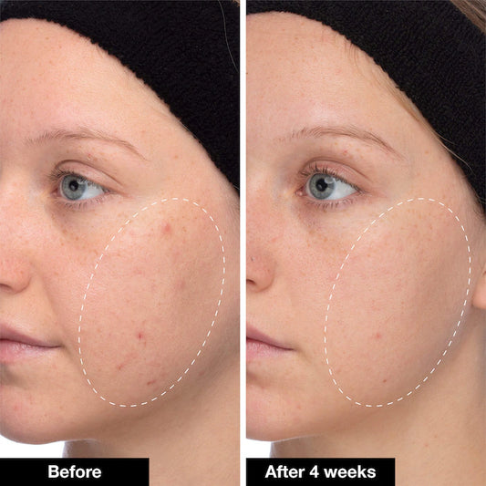 INNBEAUTY PROJECT | Slushy Serum