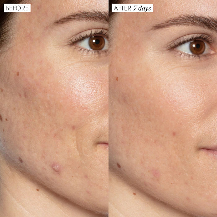 Sunday Riley | Good Genes All-In-One AHA Lactic Acid Treatment