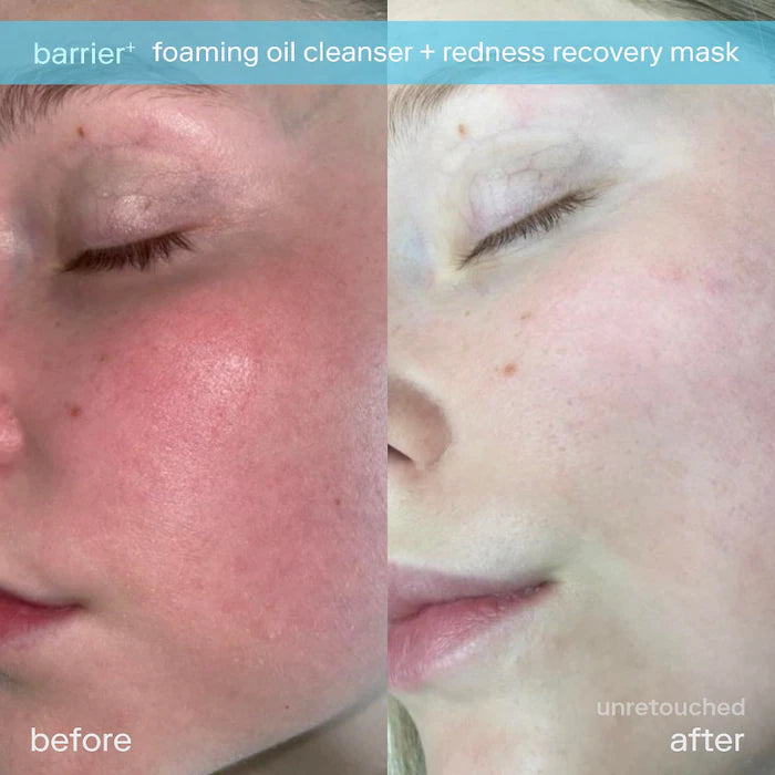 SKINFIX | Barrier+ Foaming Oil Hydrating Cleanser