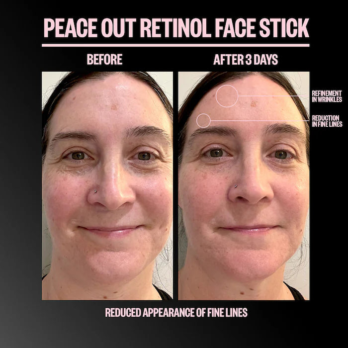 Peace Out | Retinol Face Stick