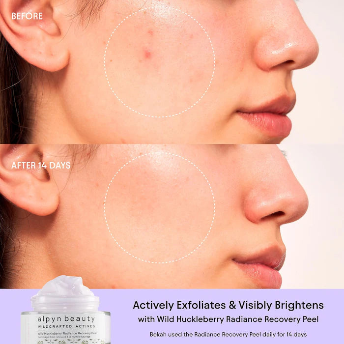 alpyn beauty | Wild Huckleberry Brightening Peel Mask for Sensitive Skin