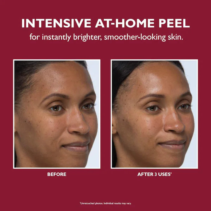 Peter Thomas Roth | Even Smoother™ Instant Reveal Facial Pee