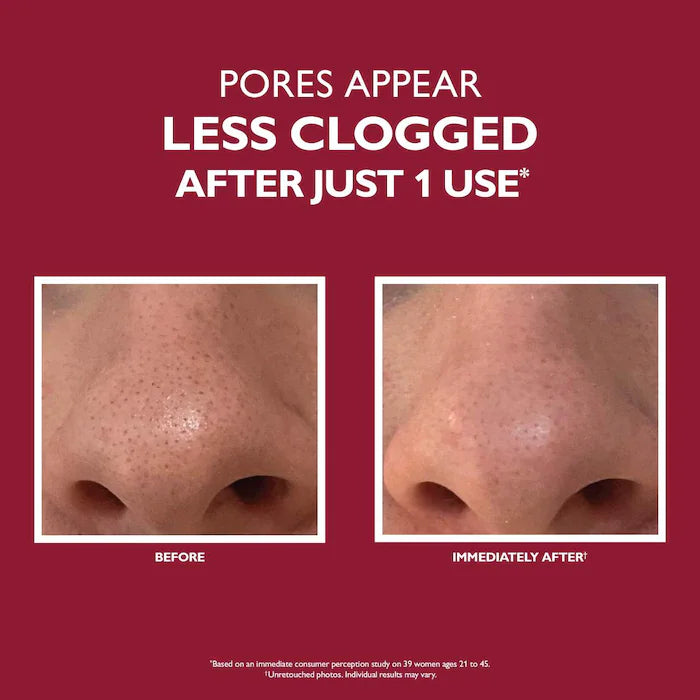 Peter Thomas Roth | Even Smoother™ Microdermabrasion Exfoliating Pore Purifier