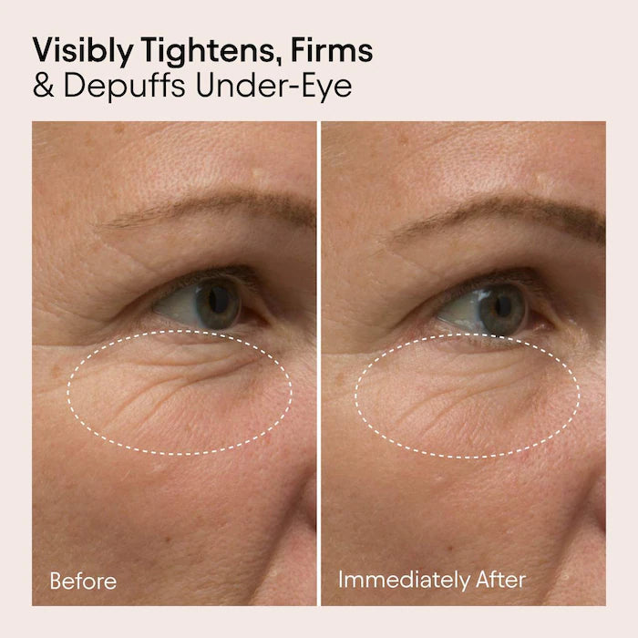 ALPYN | Line-Filling Eye Cream with Bakuchiol and Caffeine