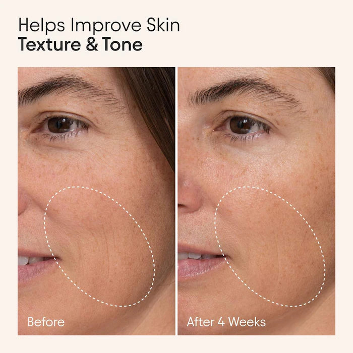 ALPYN | Wild Nettle & Niacinamide Instant Firming Serum