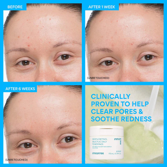 innisfree | Daily Gentle Retinol Salicylic Toner Pads