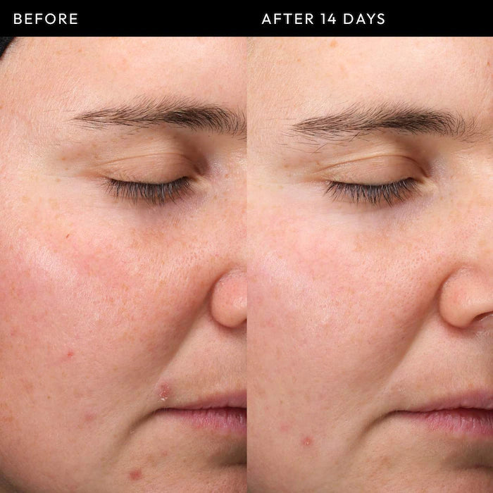 The INKEY List | Exosome Hydro-Glow Complex Serum