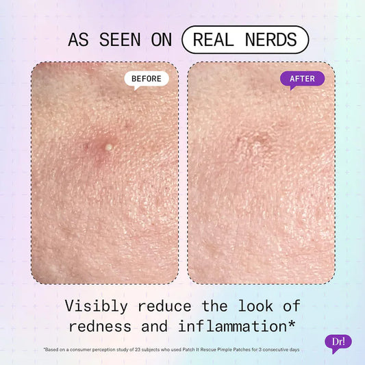 Dr. Idriss | Patch It Azelaic Acid Rescue Pimple Patches