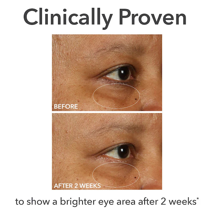 Dr. Dennis Gross | Skincare DermInfusions Fill + Repair Eye Cream