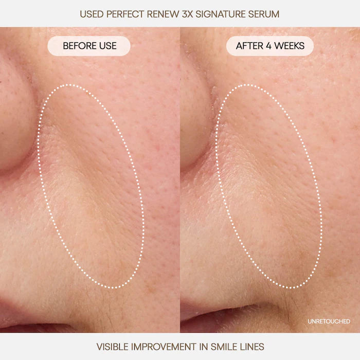 LANEIGE | Perfect Renew 3x Signature Serum Advanced for Anti-Aging, Firming & Lifting