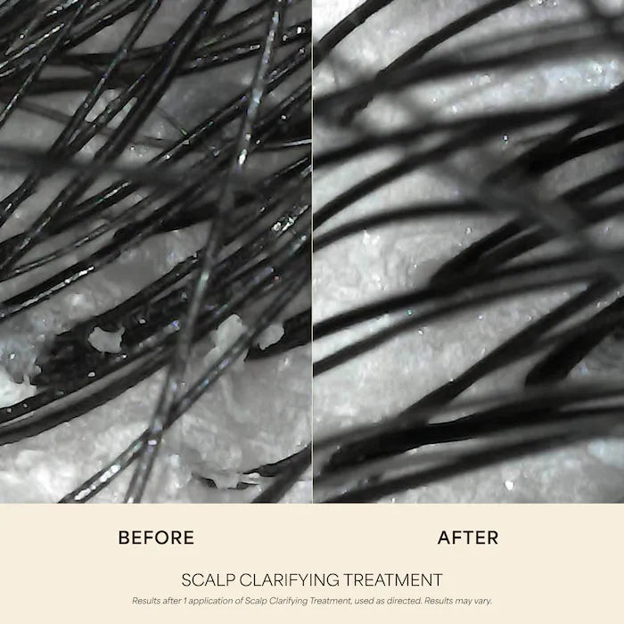 VEGAMOUR | Scalp Clarifying Treatment