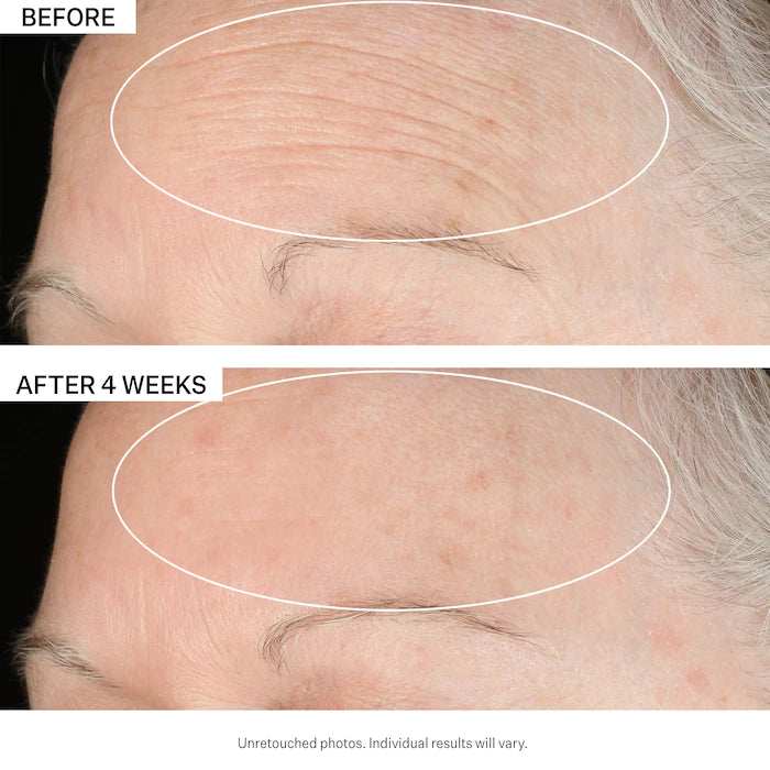 StriVectin SD | Advanced ™ PLUS Intensive Moisturizer For Wrinkles & Stretch Marks