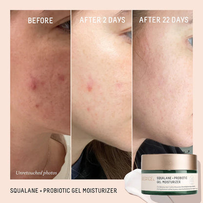 Biossance | Probiotic Balancing Gel Moisturizer + Squalane