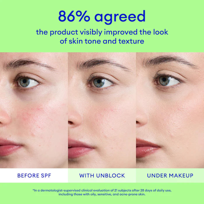 Ultra Violette | Unblock Screen SPF 50 Non-Acnegenic Facial Sunscreen with Bemotrizinol and Zinc Oxide