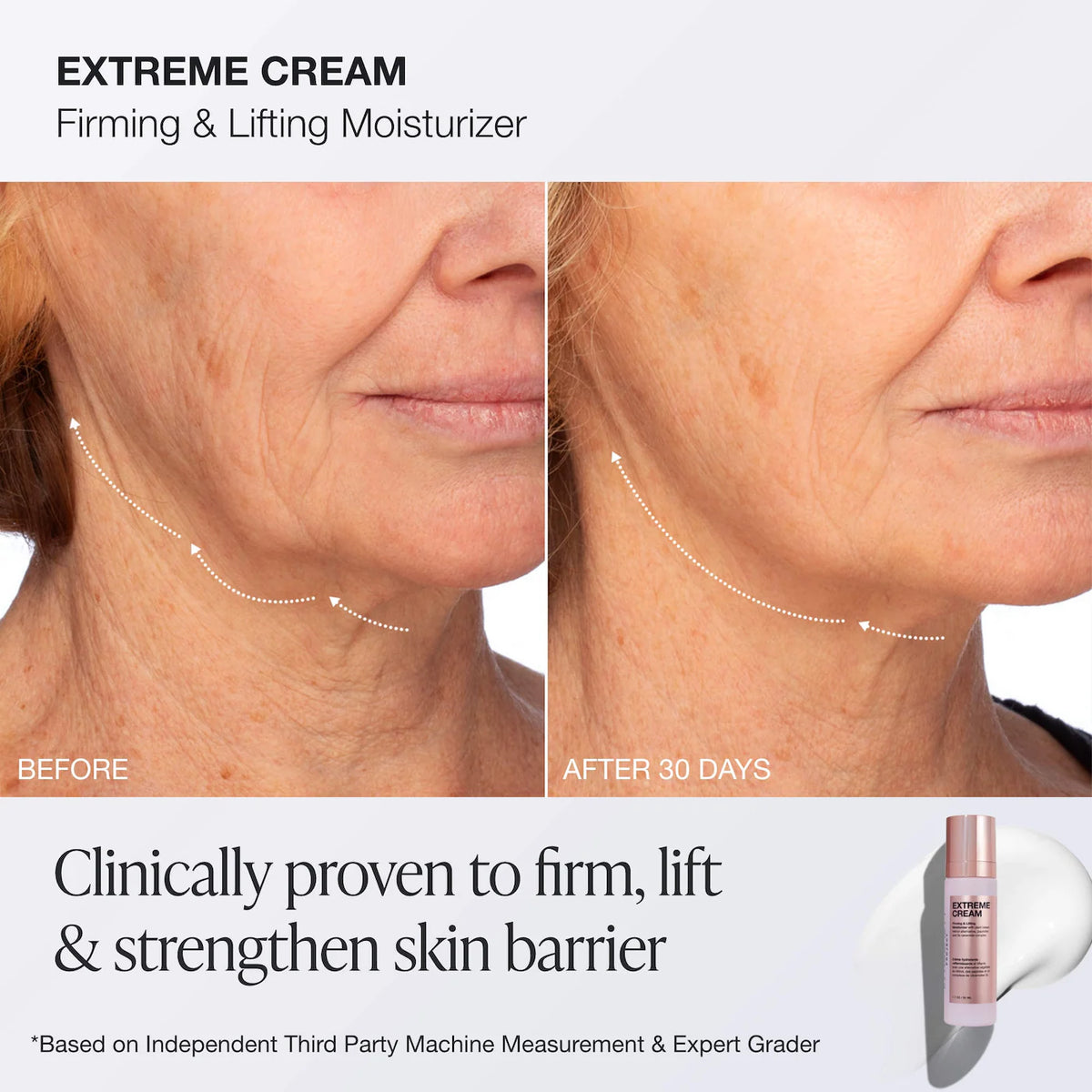 INNBEAUTY PROJECT | Extreme Routine Firming & Barrier Repair Set