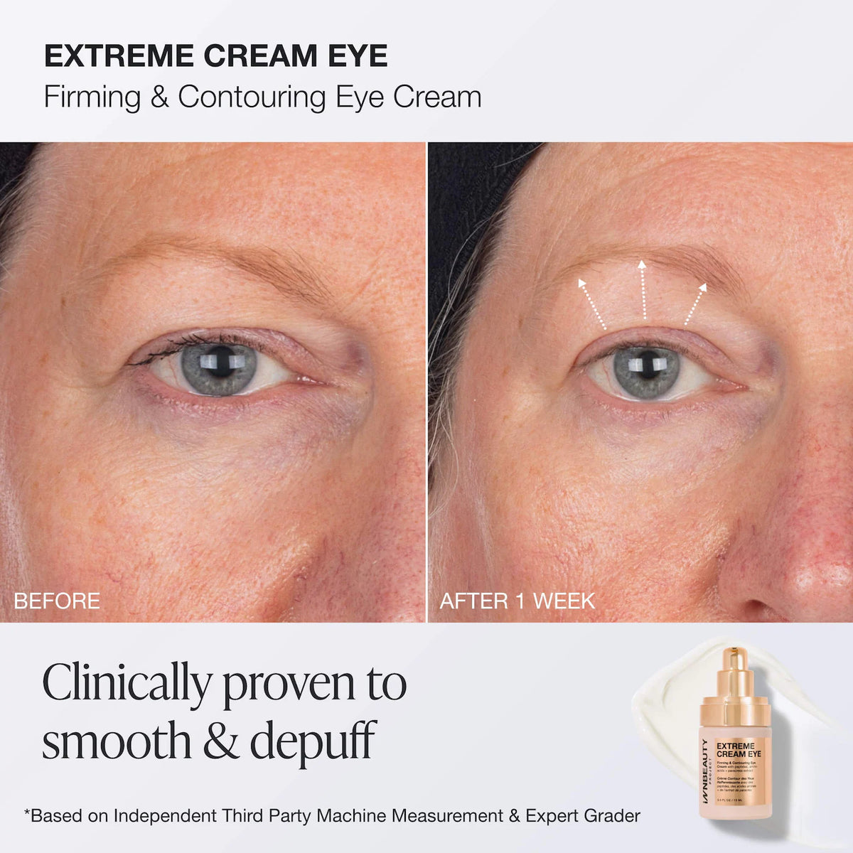 INNBEAUTY PROJECT | Extreme Routine Firming & Barrier Repair Set