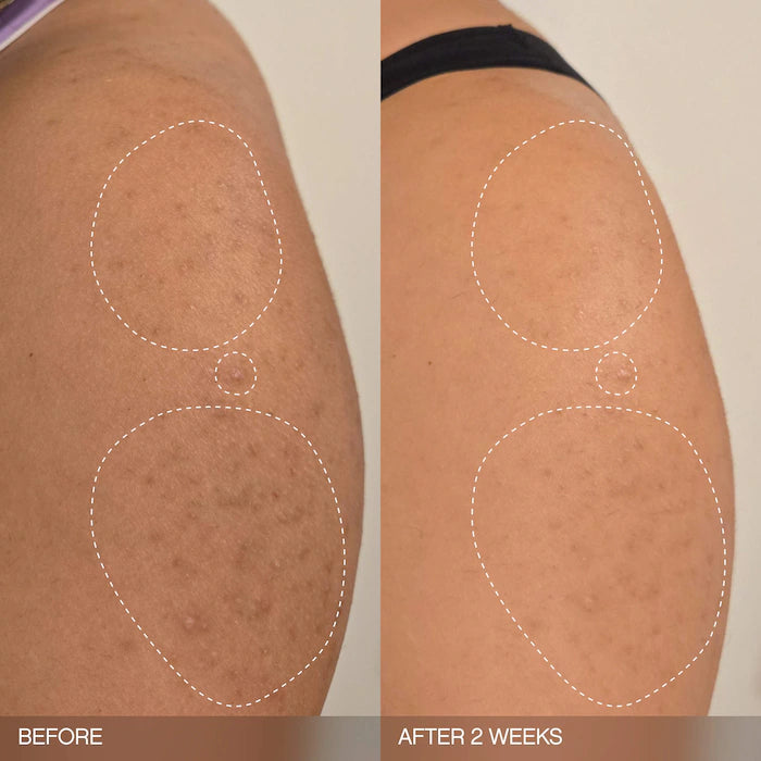 Topicals | Slather Exfoliating & Smoothing Bar - For Soft Skin  (2 Pack)