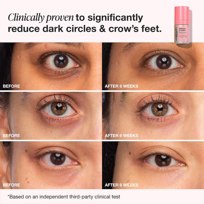 iNNBEAUTY PROJECT | Bright & Tight Dark Circle Firming Eye Cream with Vitamin C & Peptides