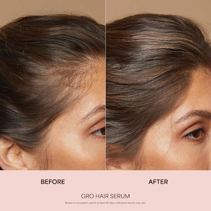 Vegamour | GRO Hair Serum and Shampoo & Conditioner Hair Gift Set