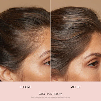 Vegamour | GRO Hair Serum and Shampoo & Conditioner Hair Gift Set