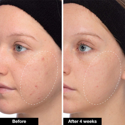 INNBEAUTY PROJECT | Slushy Serum
