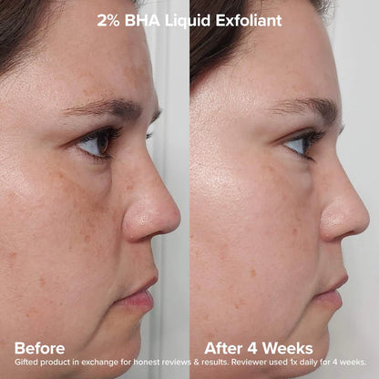 Paula's Choice | Expert Exfoliation Kit with 2% BHA + 6% Mandelic Acid AHA