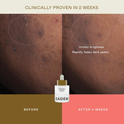 EADEM | Milk Marvel Dark Spot Serum with Niacinamide and Vitamin C