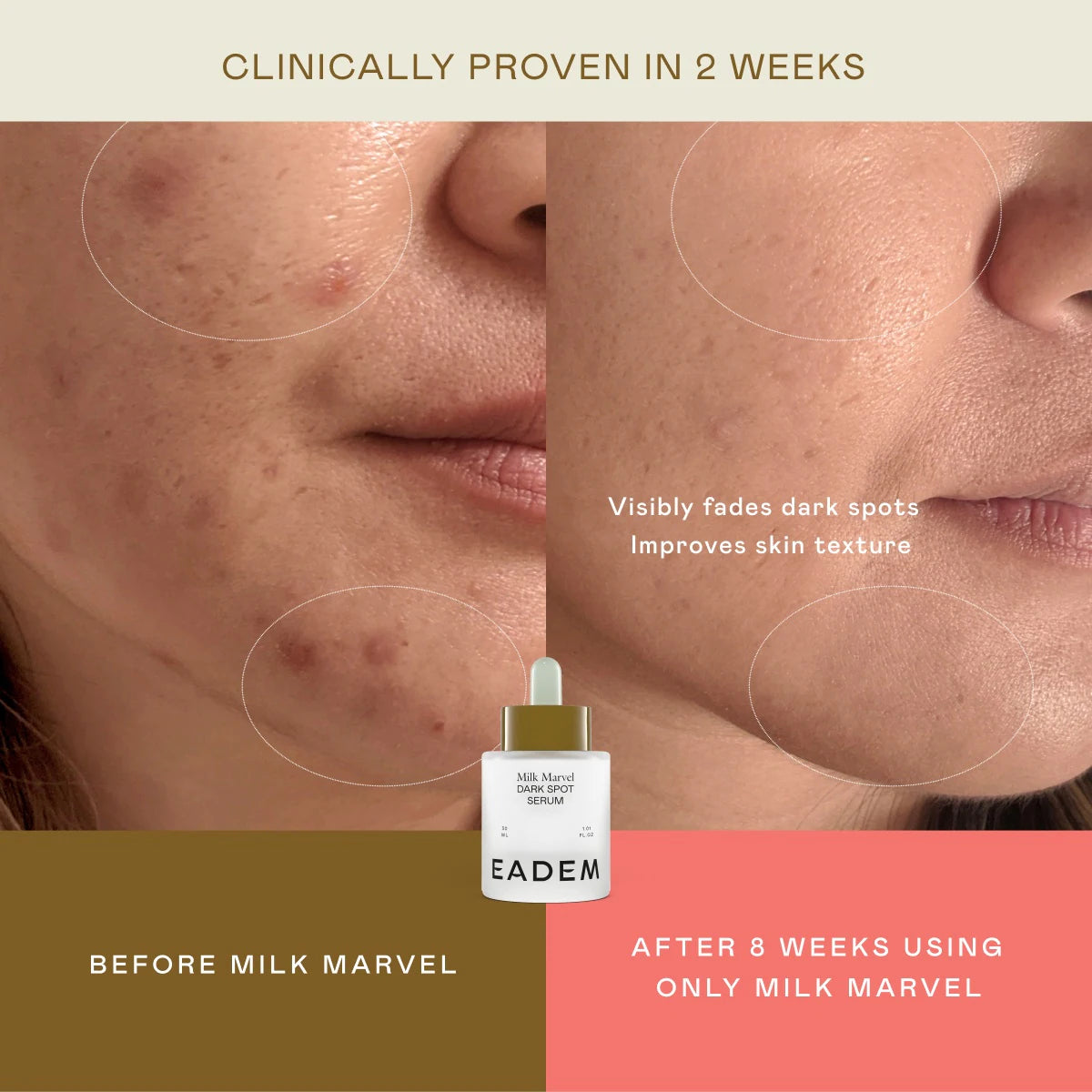 EADEM | Milk Marvel Dark Spot Serum with Niacinamide and Vitamin C