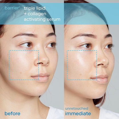 SKINFIX | Barrier+ Triple Lipid + Collagen + Niacinamide Activating Serum