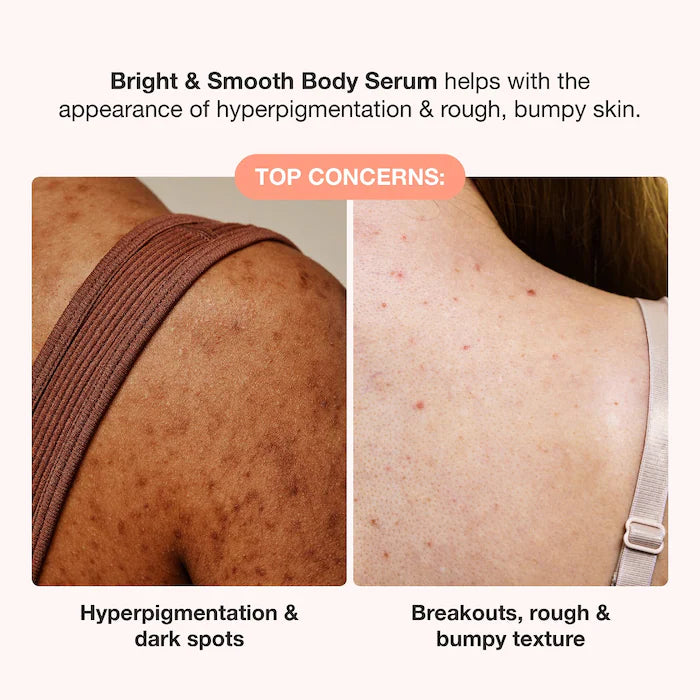 iNNBEAUTY PROJECT | Bright & Smooth Body Serum for Dark Spots & Bumps with 7% AHA + BHA