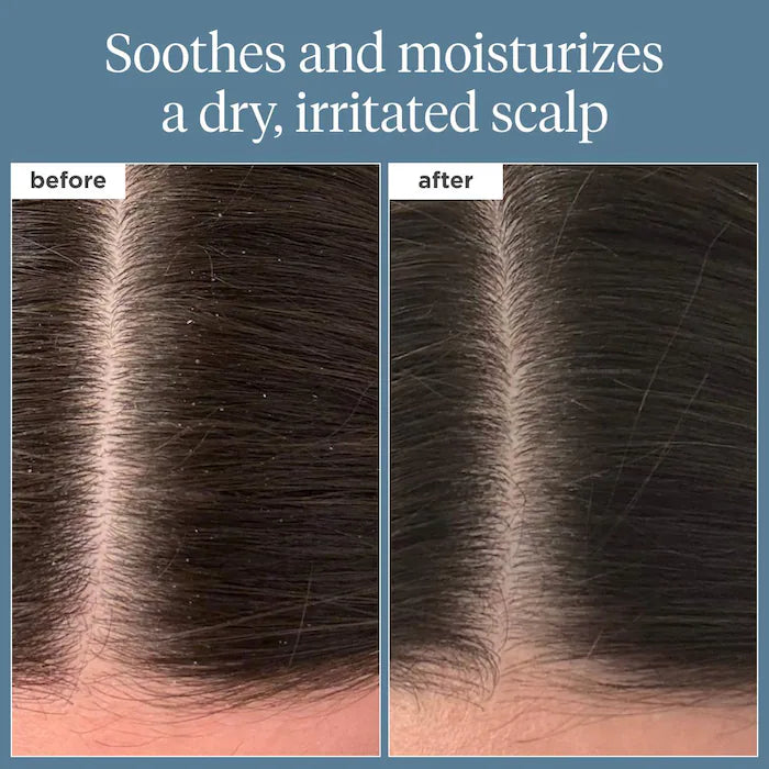 Briogeo | Scalp Revival™ Rosemary Pre-Wash Scalp and Hair Oil