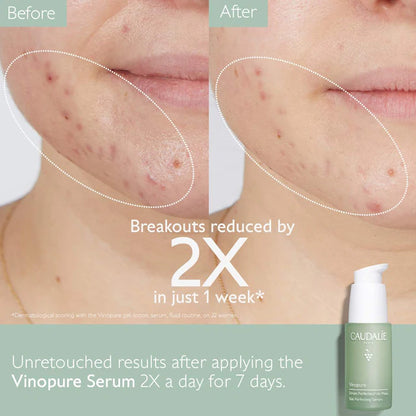 Caudalie | Vinopure Targets Acne-Prone Skin Set