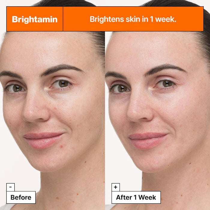 Dr. Jart+ | Brightamin Brightening Serum with Niacinamide and Vitamin C