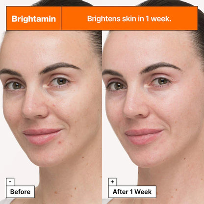 Dr. Jart+ | Brightamin Brightening Serum with Niacinamide and Vitamin C