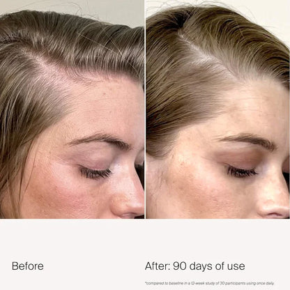 Living Proof | Scalp Care Density Serum for Thinning & Greying Hair