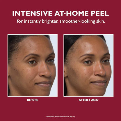 Peter Thomas Roth | Even Smoother™ Instant Reveal Facial Pee
