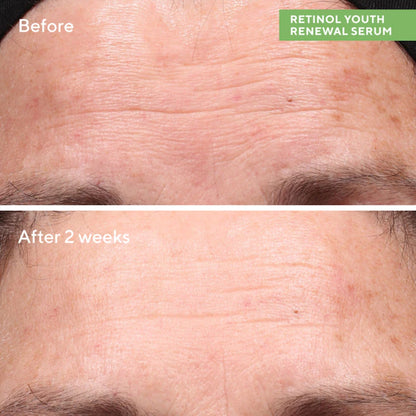 Murad | Prevent Renew with Retinol Essentials