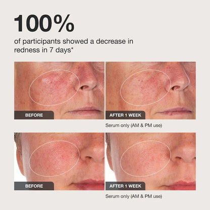 iNNBEAUTY PROJECT | Calm the Red Down Dual Chamber Redness Treatment Serum