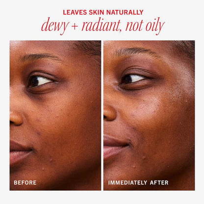 First Aid Beauty | Hydrating Dewy Gel Cream Moisturizer with Hyaluronic Acid + Ceramides