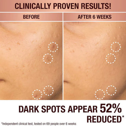 Charlotte Tilbury | Dark Spot Correcting Radiance Recovery Serum