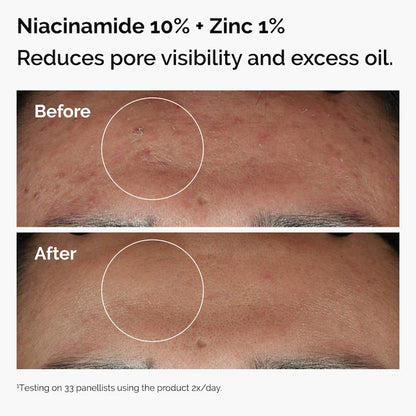 The Ordinary |  The Skin Support Set with Niacinamide + Hyaluronic Acid