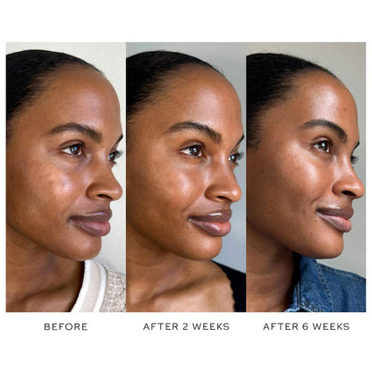 Westman Atelier | Suprême C 100% Vitamin C Brightening Serum
