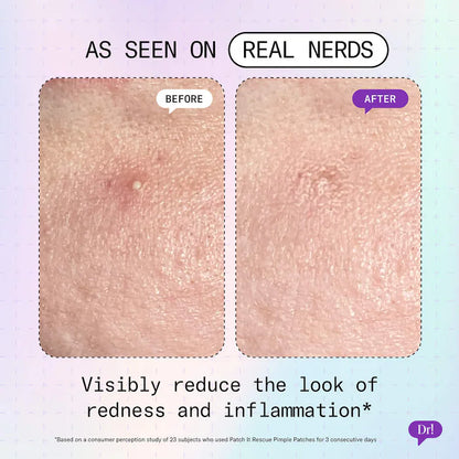 Dr. Idriss | Patch It Azelaic Acid Rescue Pimple Patches