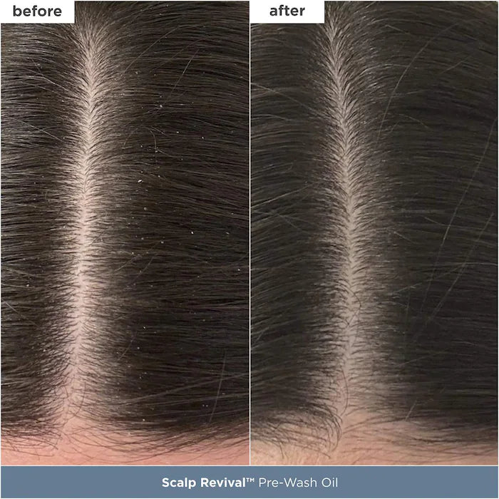 Briogeo | Scalp Revival™ Bestsellers Value Set for Itchy, Dry Scalp Relief