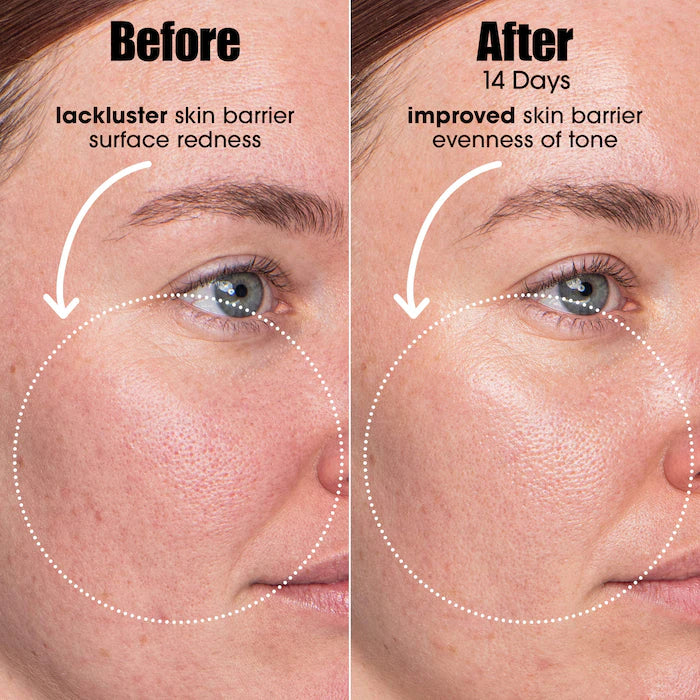 Sunday Riley | A.I. Adaptive Retinoid Serum For Blemish Prone Skin