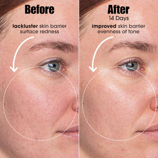 Sunday Riley | A.I. Adaptive Retinoid Serum For Blemish Prone Skin