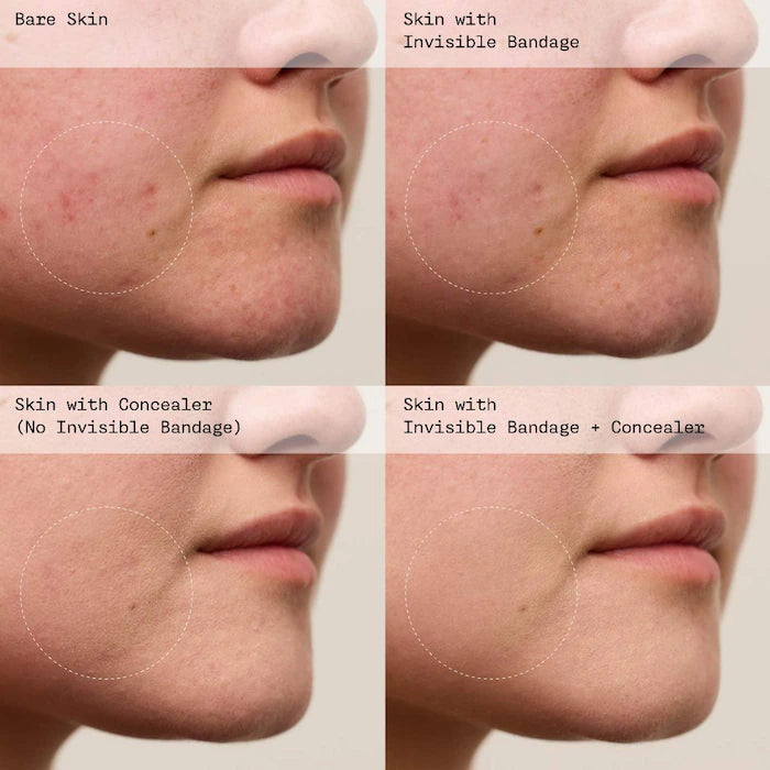 VIOLETTE_FR | INVISIBLE BANDAGE Protect + Prime Solution Gel with Niacinamide