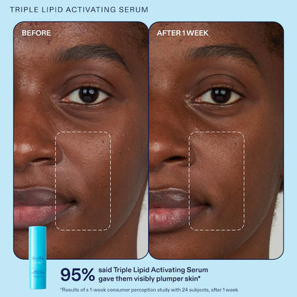 Skinfix | Plump + Comfort Kit