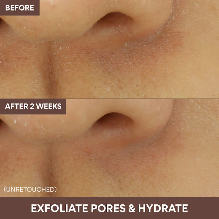 innisfree | Volcanic Swirl Exfoliating Pore Mask
